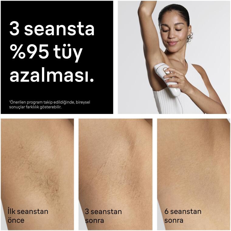 Braun IPL Silk·expert Pro 5, Evde Lazerle Tüy Alma, Çanta, Gillette Venus, 3 Başlık, PL5311